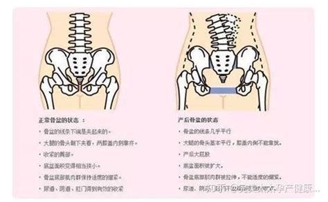 测量骨盆演示图图片