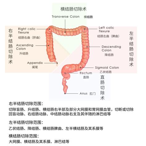 肛门息肉图片