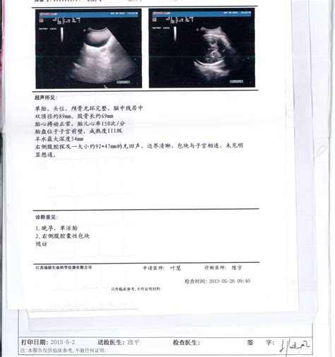 怀孕B超单生成器