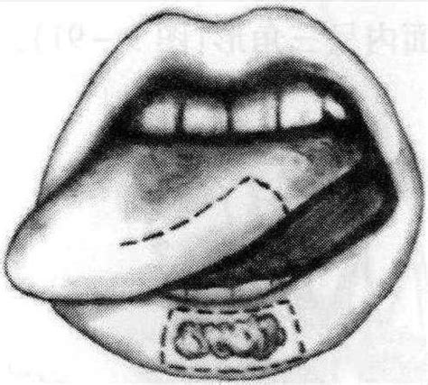 世界上最奇葩的手术 分舌术把舌头分成蛇（相当恐怖）-小狼观天下