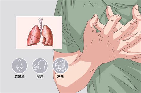 流感病毒肺炎是流感最重要的并发症之一，哪些诊断和治疗的规范必须掌握？-健康教育-清华大学附属北京清华长庚医院呼吸与危重症医学科