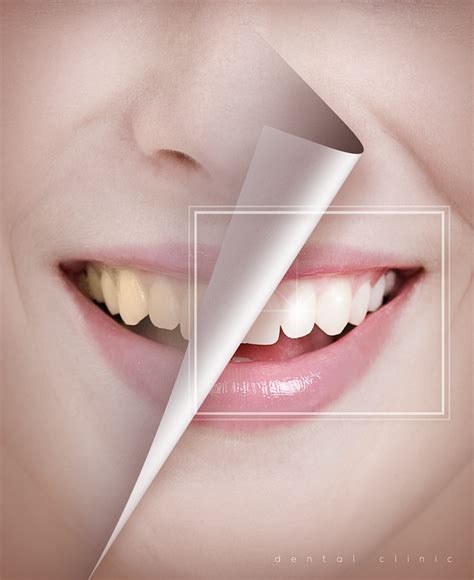 大气牙科健康口腔健康牙科医院美白牙齿海报_广告设计_电商设计灵感 - 7msj.com