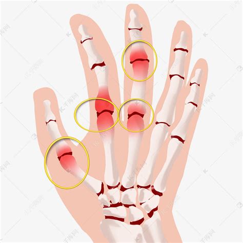 手指关节疼痛的原因-百度经验