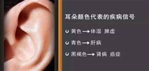 入耳式耳机危害耳朵，千万不要这样戴！正确使用耳机方法是这样！__财经头条