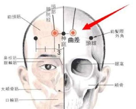 常见4种头痛类型，试试按摩这些穴位 - 知乎