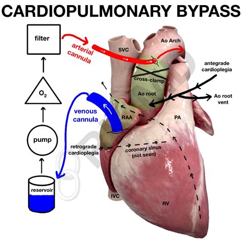 CABG | Coronary Artery Bypass Surgery | Valley Health System