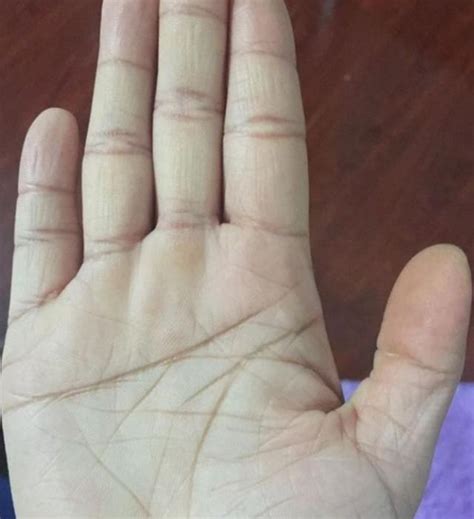 gth断掌事件图片