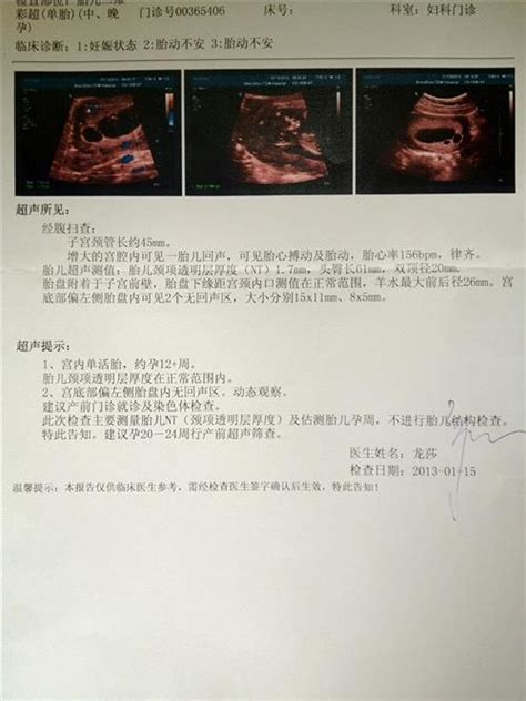 23周彩超检查胎儿鼻骨标准正常值是多少_第二人生