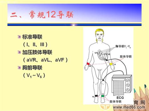 心电图连接示意图图片