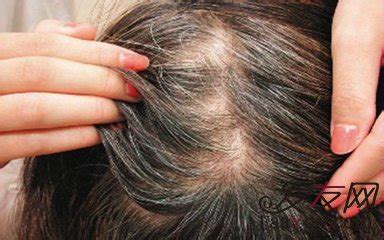 头发稀疏的原因有哪些？都是这5个习惯导致的 | 说明书网