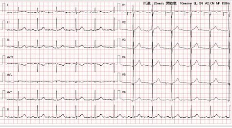 图图标_88ICON https://88icon.com 医学 心脏 脉搏 心电图 心率