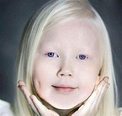 白化病儿童女孩蓝眼睛的特写照片