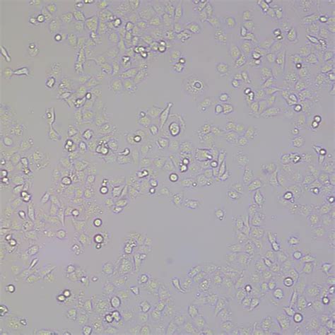 T24-LUC-GFP-Puro双标记的人膀胱移行细胞癌细胞-企业官网