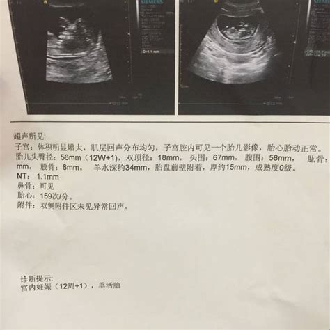 3个月胎儿性别图片_怀孕三个月胎儿性别图 - 随意云