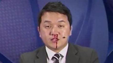 韩国解说员直播中鼻血狂流 吓坏搭档笑坏网友_凤凰网视频_凤凰网