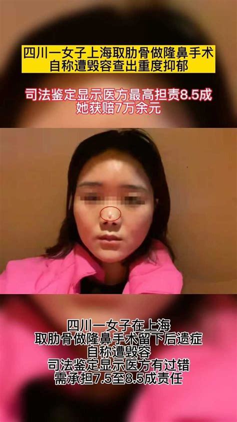 四川一女子上海取肋骨做隆鼻手术自称遭毁容，查出重度抑郁，司法鉴定显示医方最高担责8.5成，她获赔7万余元 ！_腾讯视频
