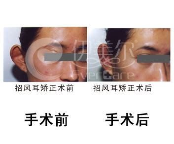 女人印堂凹陷图片
