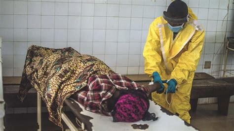 科学网—埃博拉出血热：临床表现 - 徐向田的博文