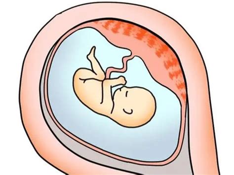 解读胎盘前壁和后壁的三大区别，哪个顺产疼一看便知|孕期知识|糖糕妈妈育儿网