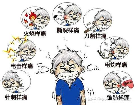 国医大师徐经世：头痛的六经辨治经验