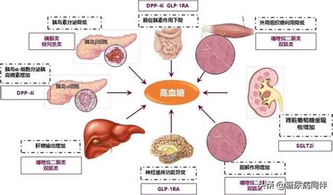台湾省发布《2型糖尿病新药治疗路径图》，二甲双胍：那我走？_糖尿病_医脉通