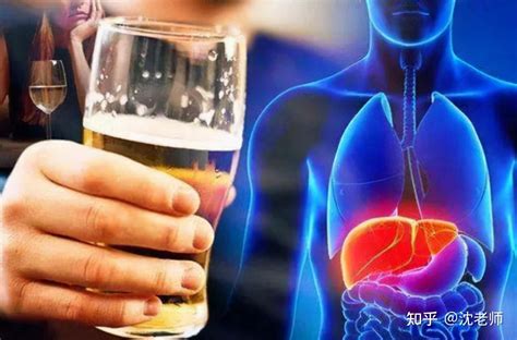 “喝酒伤肝”？LPS亚铅提醒酒精除了会伤肝，对人体还有这些伤害 - 知乎