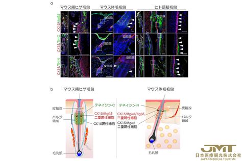 JMT日本医疗——与“器官置换再生医疗”相关的成果-理研确立毛囊干细胞培养方法⑤