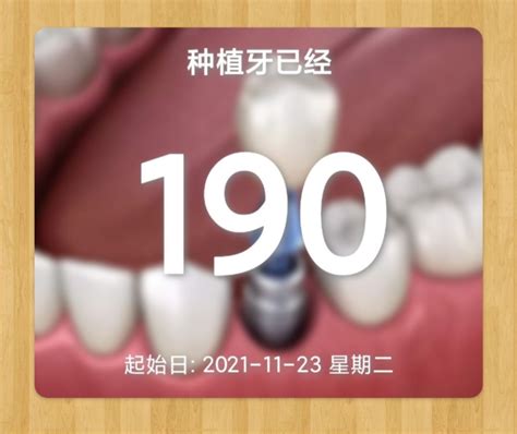 赣州种植牙多少钱一颗？都包含了种牙的哪些费用,牙齿修复-8682赴韩整形网