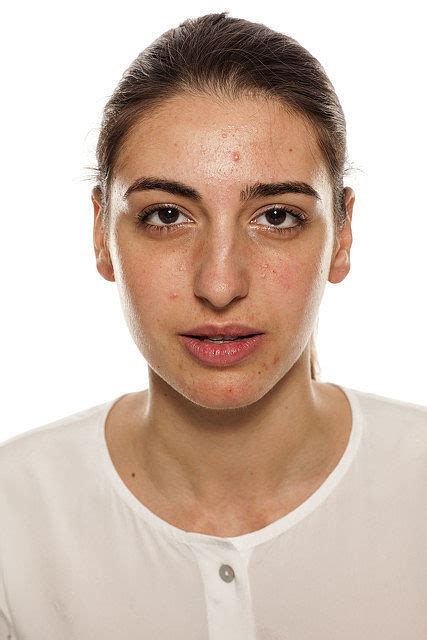 女人脸皮肤问题的概念高清图片下载-正版图片507353012-摄图网