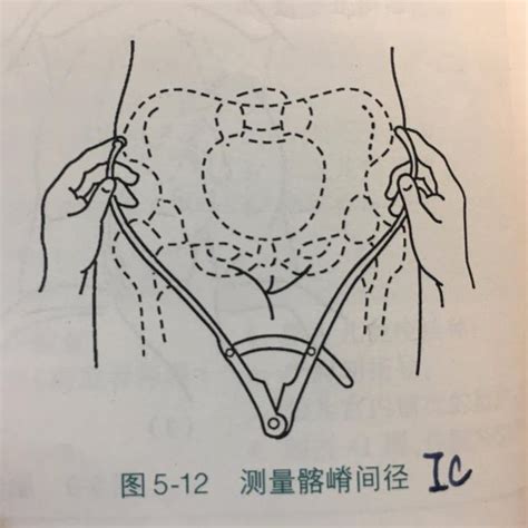 坐骨棘位置示意图图片