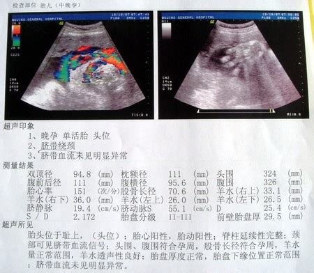 一文详解孕期B超单图像看法，是男是女看这几个数据就知道_家庭医生在线