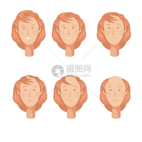 秃顶的女人头套好了脱发故事板成的六个全脸秃顶的女人角色各个点矢量插图插画图片下载-正版图片300923762-摄图网