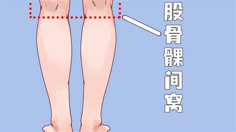 腘窝位置图图片