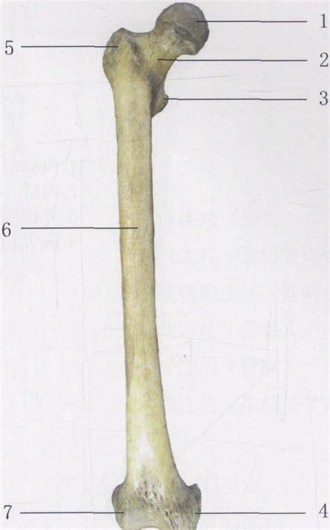 图3-43 股骨(前面)-基础医学-医学