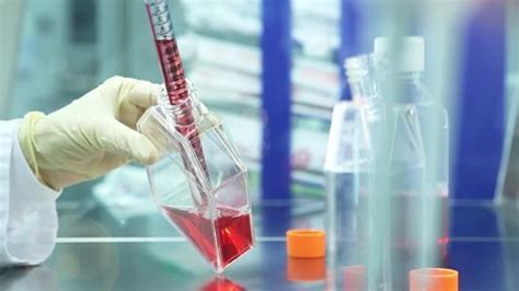 贵州省血液中心开展备用试剂确认工作-中国输血协会