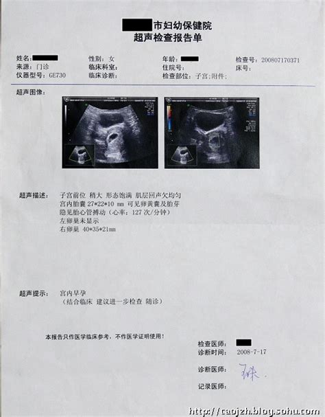 怀孕6周第一次照B超，单子看不懂_百度宝宝知道-怀孕42天第一次照B超，单子看不懂