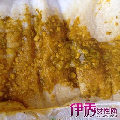 果酱样大便图片