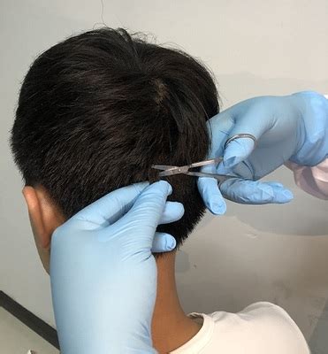 检测头发-毛发检测-头发检测机构-正光毛发检测中心 - 正光毛发检测机构