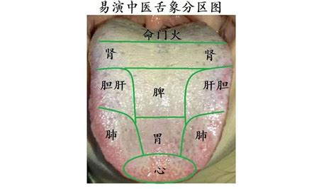 舌苔图解图片