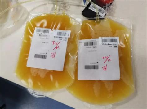 献血小板和献全血究竟啥区别？_献血者