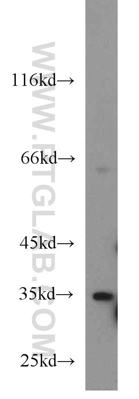 DARC Antibody 55185-1-AP | Proteintech