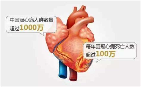 医生教你如何远离心脏性猝死-微专栏-第145期-中国数字科技馆