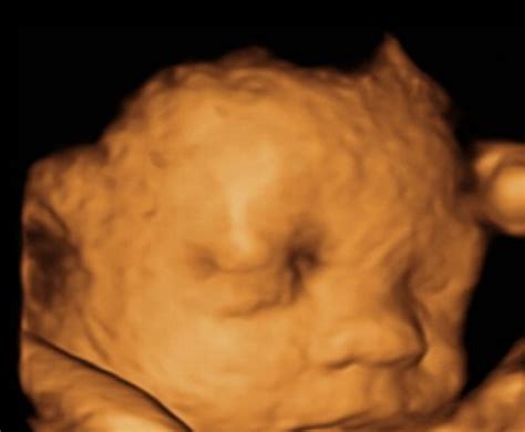 【七个月的胎儿姿势】【图】七个月的胎儿姿势 教你怀孕7个月怎样吃最好(3)_伊秀亲子|yxlady.com
