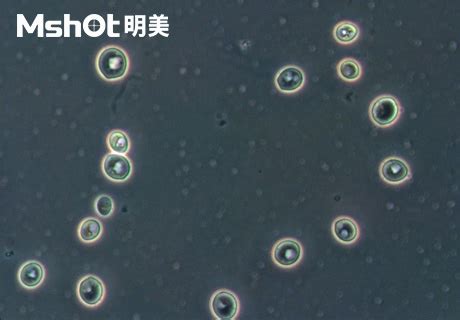显微镜下的酵母菌 -明美光电