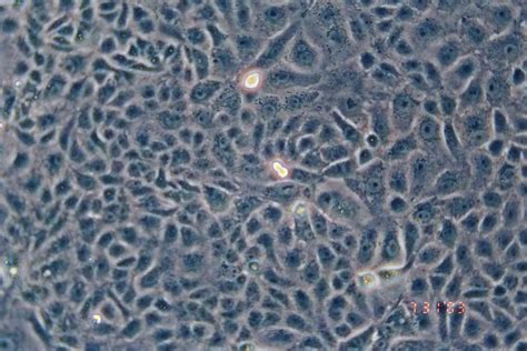VERO C1008细胞ATCC CRL-1586细胞 VEROC1008非洲绿猴肾细胞株购买价格、培养基、培养条件、细胞图片、特征等基本信息_生物风