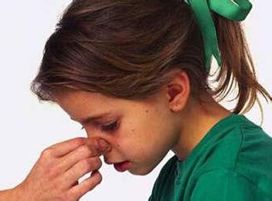 紧急护理：孩子流鼻血时该怎么办