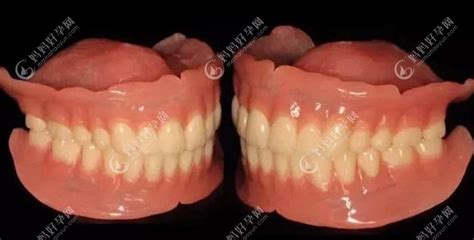 安活动假牙当前最新最好材料:纯钛/维他灵/全口吸附性义齿pk-儿牙-妈妈好孕网
