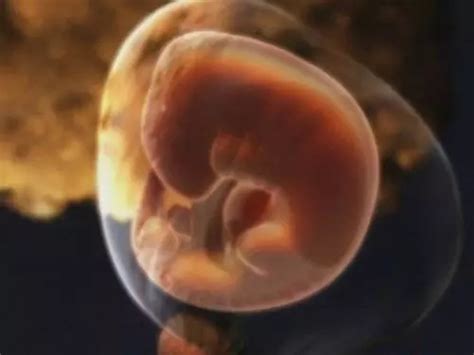 四个月胎儿真实图