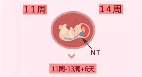 预防胎儿畸形吃什么药