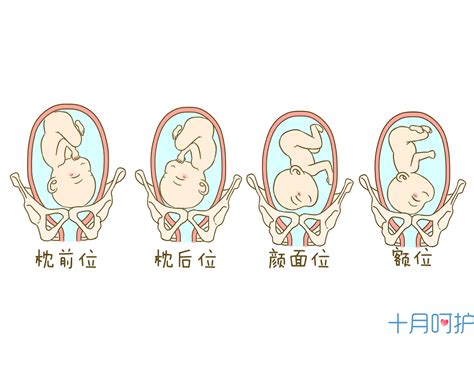 胎儿胎位偏下